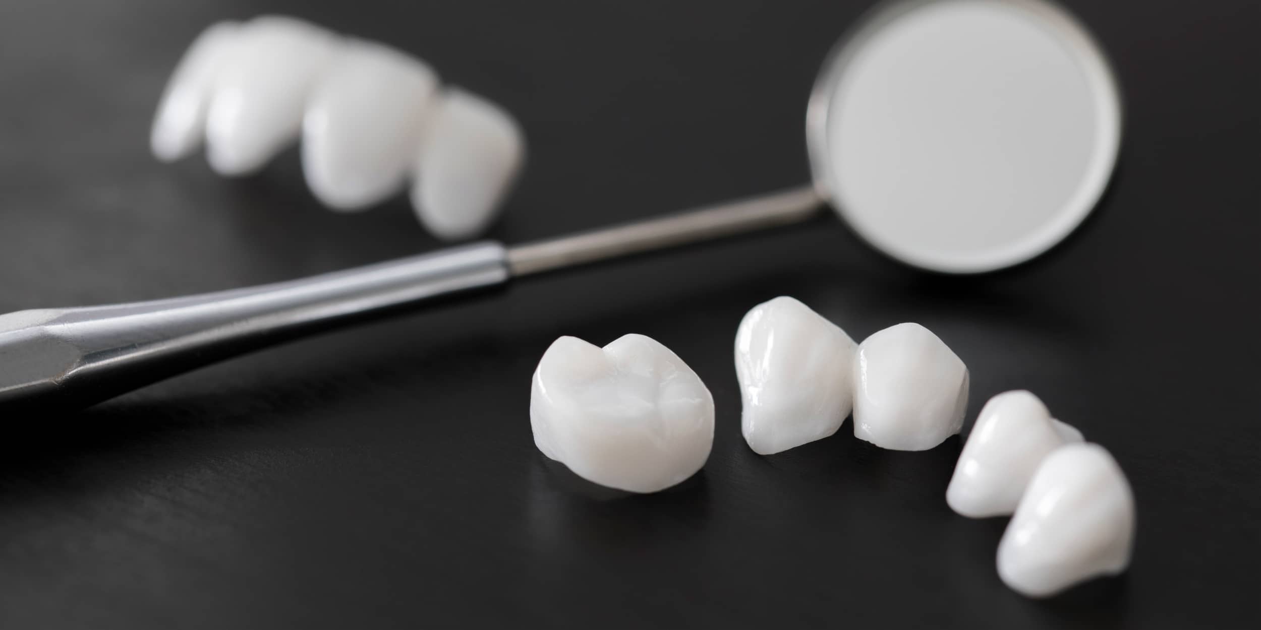 Quelle est la différence entre facette dentaire et couronne ? | Dr Elhyani | Paris
