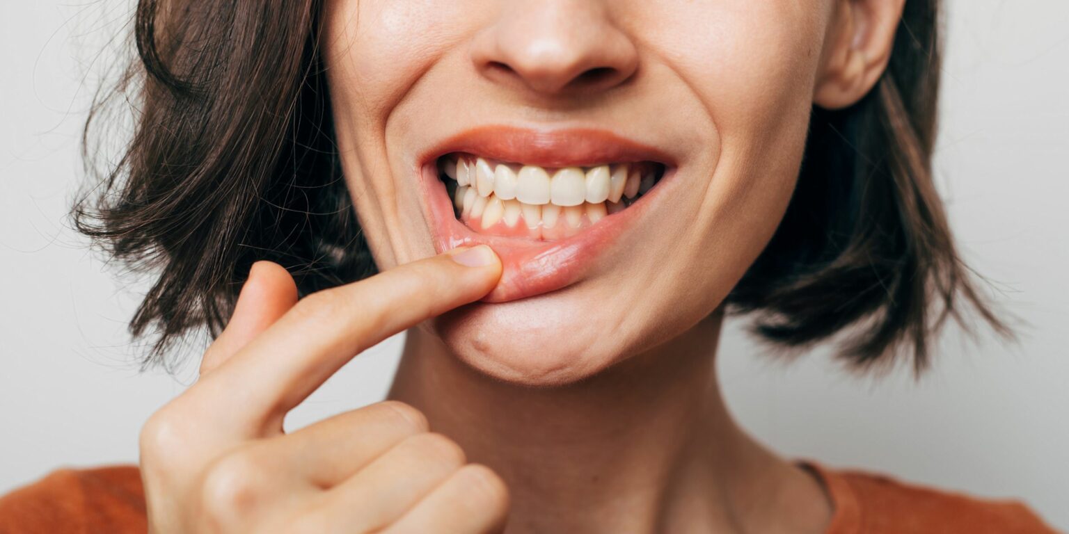 Goût amer dans la bouche quelles en sont les causes ? Dr Elhyani Paris