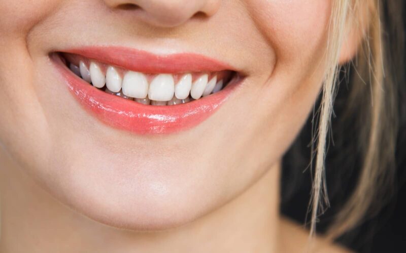 Mes dents ont bougées après un traitement orthodontique : que faire ? | Dr Elhyani | Paris