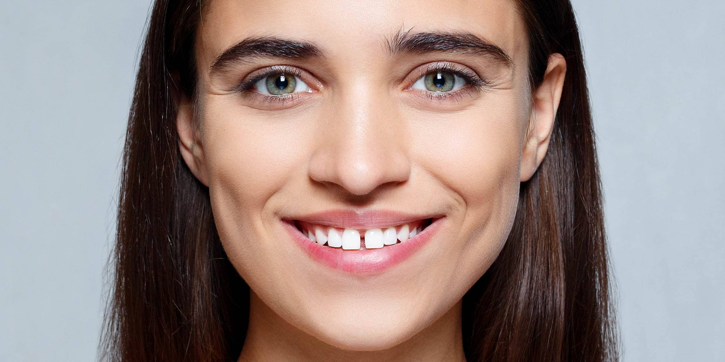 Les facettes dentaires : une solution pour corriger les dents du bonheur | Dr Elhyani | Paris