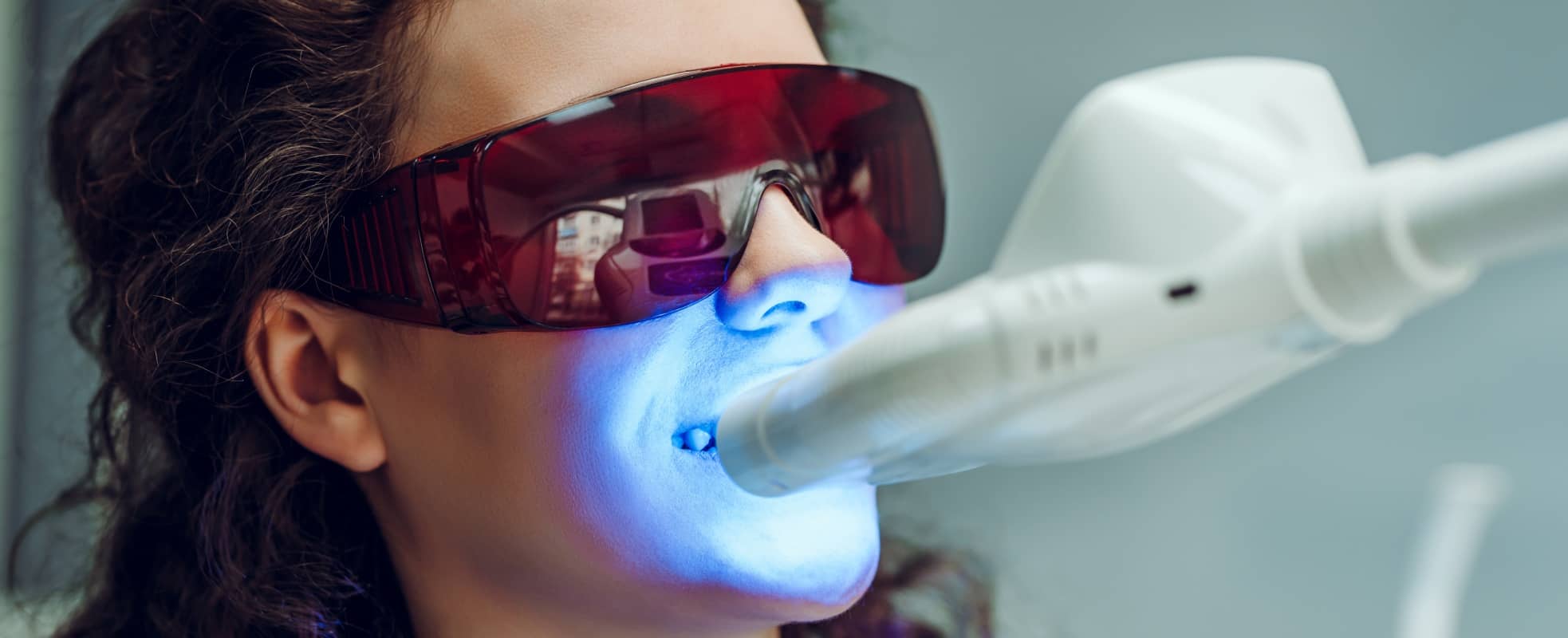 Combien de temps un blanchiment dentaire fait-il effet ? | Dr Elhyani | Paris