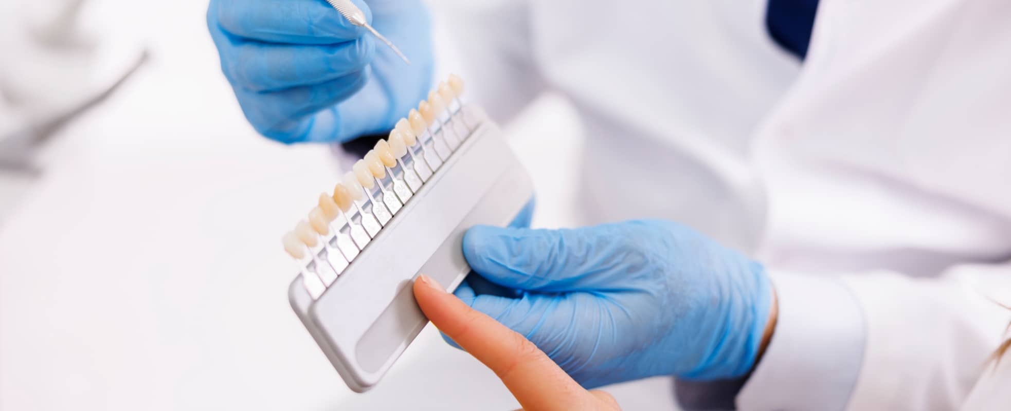 Je n'aime pas mes dents de devant : les facettes dentaires sont-elles la solution ? | Dr Elhyani | Paris