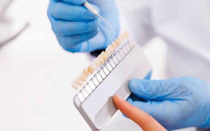 Je n'aime pas mes dents de devant : les facettes dentaires sont-elles la solution ? | Dr Elhyani | Paris