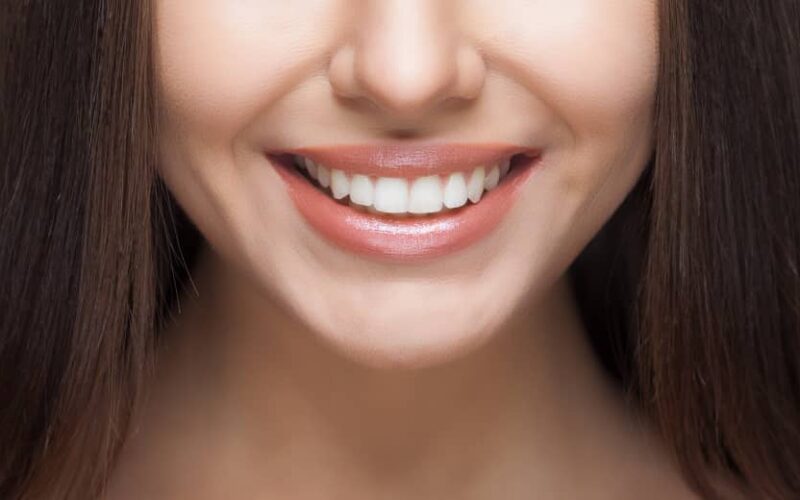 Les résultats des implants dentaires offrent-ils un sourire naturel ? | Dr Elhyani | Paris