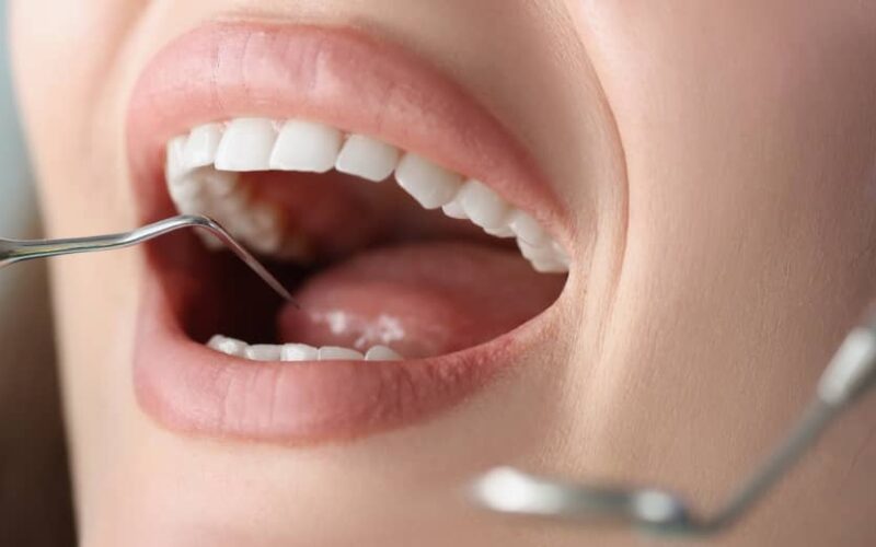Que peut-on manger en cas de parodontite ? | Dr Elhyani | Paris